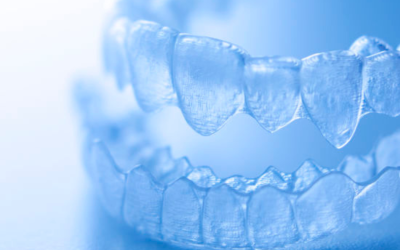 Eating with Clear Aligners: Tips from Dr. Weber at Weber Orthodontics